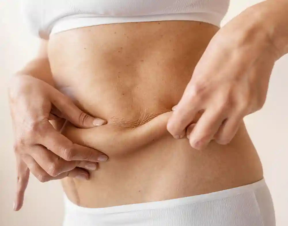 Mujer pellizca la piel de su abdomen para mostrar la pérdida de firmeza y la flacidez cutánea